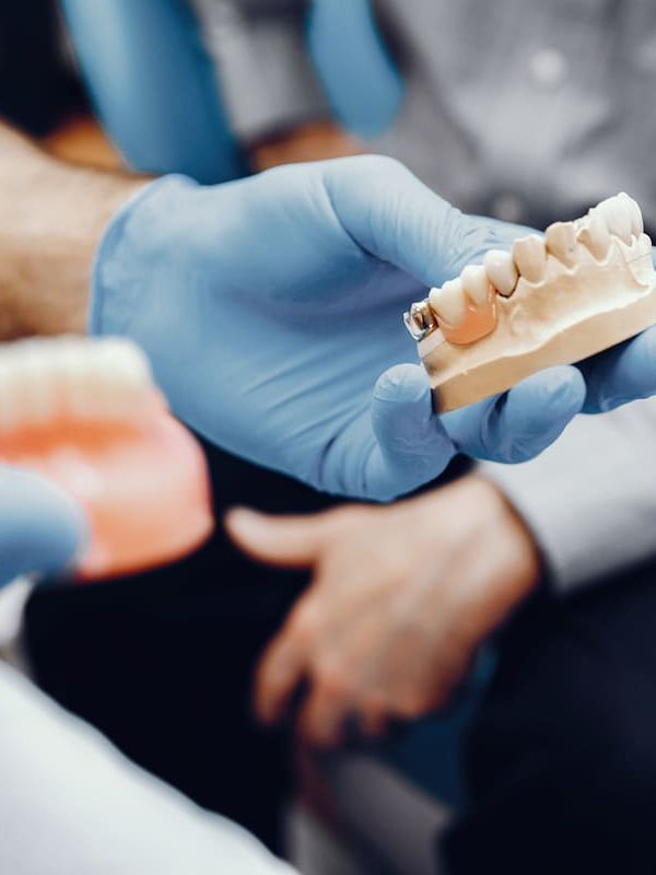 Protesi Mobili e Protesi Mobili su Impianti: Qual è la Soluzione Migliore?