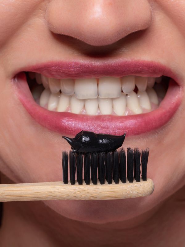 Sbiancamento dentale e “Moda del Whitening”: Quando il Trend diventa un rischio