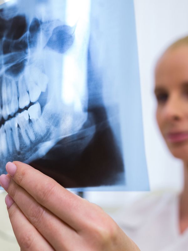 Fa male? Quanto dura? Quanto costa? Tutte le risposte sull’implantologia